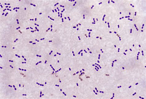 streptococcus pneumoniae morphology